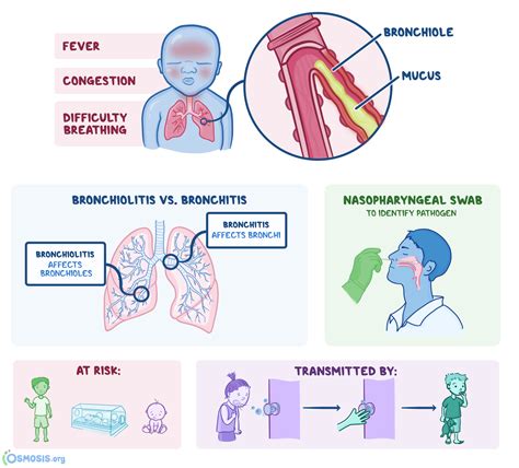 Bronchitis Diagnosis