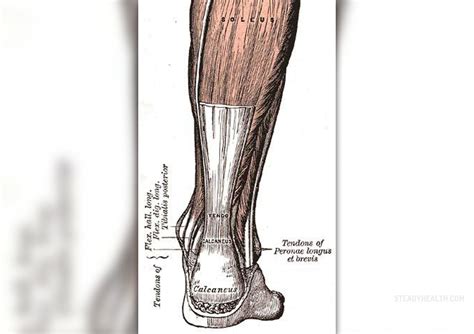 Achilles tenotomy in achilles tendon | Musculoskeletal Issues articles ...