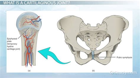 Cartilaginous Joint | Structure, Function & Examples - Lesson | Study.com