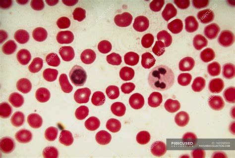 Light micrograph of human red blood cells (erythrocytes), with two ...