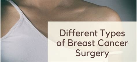 Different Types of Breast Cancer Surgery - Queknow