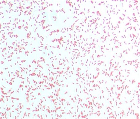 Gram stain of A. ihumii strain AP11 T | Download Scientific Diagram