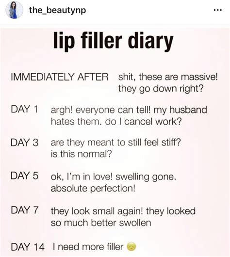 funny lip filler quotes - Loudly Diary Image Library