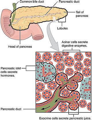 Pancreatic cancer - Wikipedia