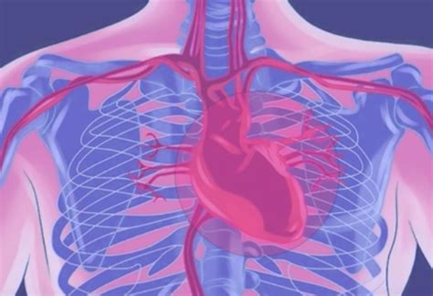 Angina Pectoris - Symptoms, Causes Treatment