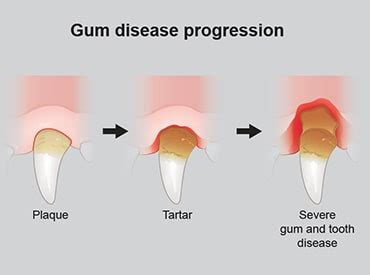 Tooth and gum disease in dogs - PDSA