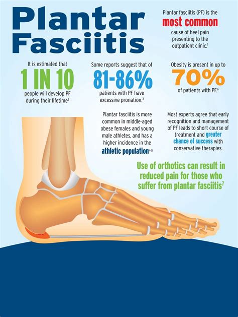 Plantar Fasciitis Symptoms and Causes