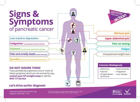 Pancreatic Cancer Symptoms : Pancreatic Cancer 16 Warning Signs You ...