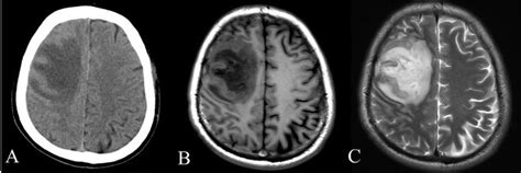 What is the Difference Between a CT Scan and an MRI? | ImageCare Centers