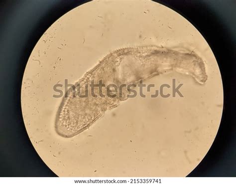 Photo Demodex Face Mites Under Microscope Stock Photo 2153359741 ...