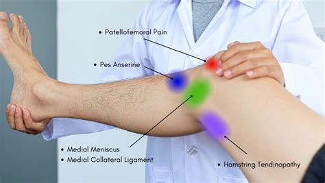 Knee Pain Location Chart | Learn the Pain Location of Knee Injuries