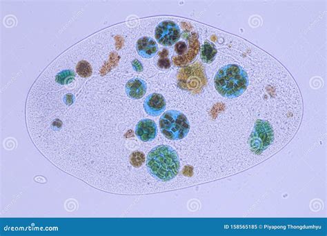 Frontonia Sp. Unicellular Ciliate Protists Under The Microscope. Stock ...