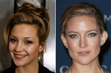 Celebrity Nose Jobs - Before & After - Mirror Online