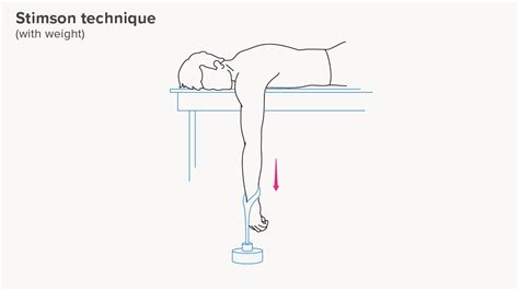 How to Pop Your Shoulder and What to Do After