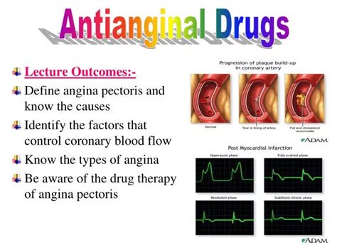 PPT - Lecture Outcomes:- Define angina pectoris and know the causes ...