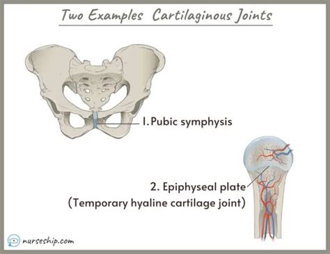 Different Types of Joints in The Human Body |Examples |Images ...