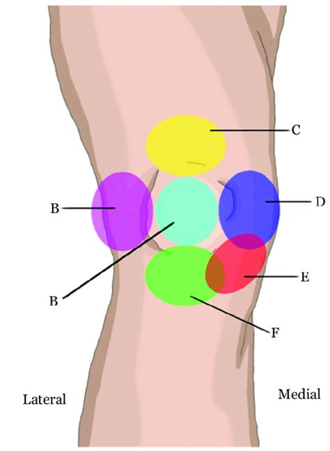 Self Diagnosing Knee Pain | Vancouver Chiropractic Care