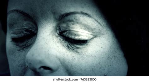 57 Corneal Perforation Images, Stock Photos & Vectors | Shutterstock