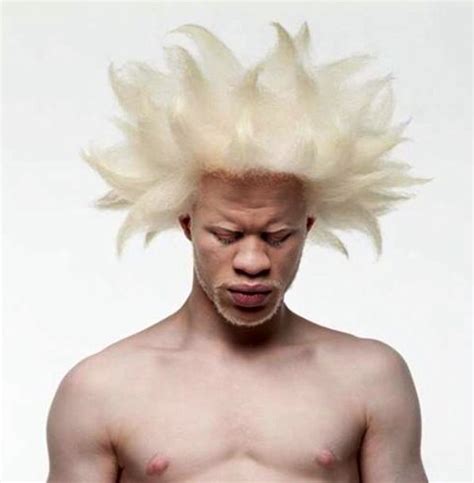 Albino Afro『pιn : ѕoyvιrgo』 ♡soyvirgo.com♡ˎˊ˗』 | Albino men, Natural ...