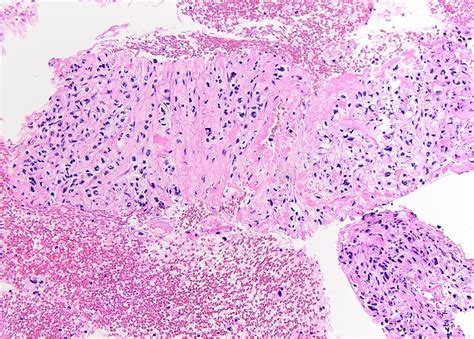 Digestive system cytology | Atlas of Pathology