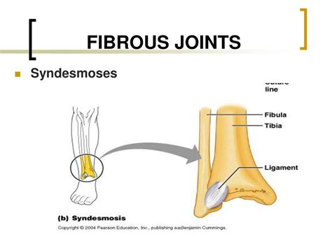 Types Of Fibrous Joints