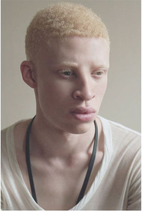 Albino male model – Wkcn