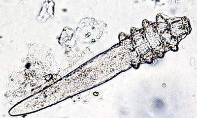 Causes of Rosacea: Demodex Mites & Microbes | Rosacea.org