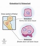 Image result for Osteoblasts in Bone