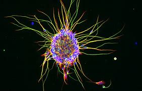 Image result for Small Granule Cells