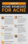 Image result for Acne Scars Home Remedy