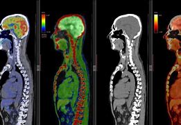 Image result for PET/CT For