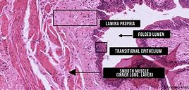 Image result for Ureter Histology Slides Labeled