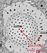 Image result for Bone Cells in Pores