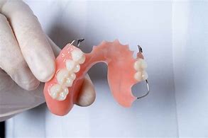 Image result for Acrylic Denture with Wrought Wire Clasps