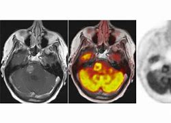 Image result for Pet MRI Scan