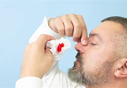 Image result for African Nose Bleed