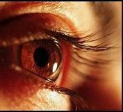 Image result for High Blood Pressure Eye Symptoms