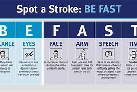 Image result for Stroke Fast AHA