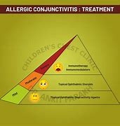 Image result for Allergic Conjunctivitis Treatment