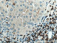 Image result for CD4 Liver