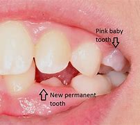 Image result for Pink Tooth Dog