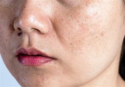 Image result for Human Skin Pores