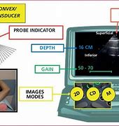 Image result for Lung Ultrasound Probe