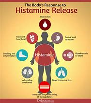 Image result for Post Pico Genesis Histamine Reaction