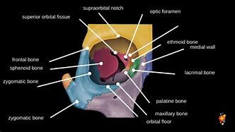 Image result for Orbital Rim Bones