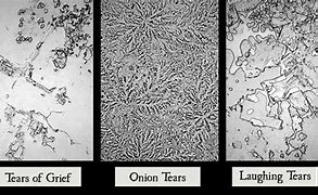 Image result for Grief Tears Under Microscope