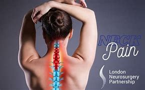 Image result for Spinal Neck Pain