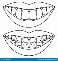 Image result for Carny Teeth