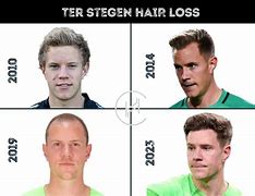 Image result for Marc-Andre Ter Stegen Long Hair