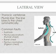 Image result for Standing Posture Plumb Line